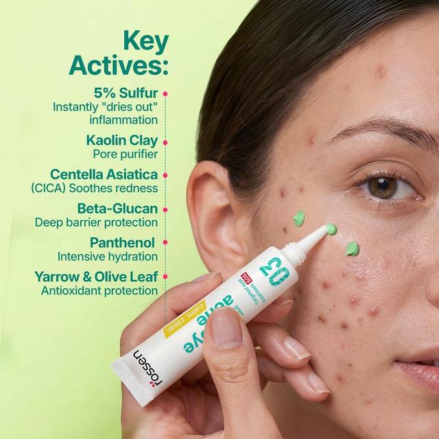 BYE-BYE-ACNE---SASTOJCI---2